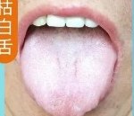 枯白舌