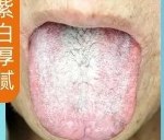 紫白厚腻舌