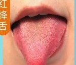 红绛舌