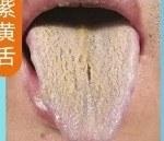紫黄舌