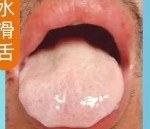 水滑舌